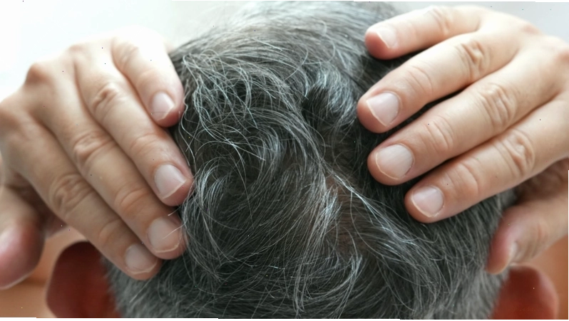 Cơ chế hình thành tóc bạc liên quan sắc tố melanin