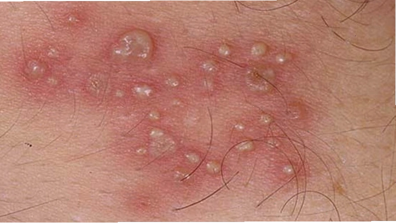 Cơ chế lây truyền virus