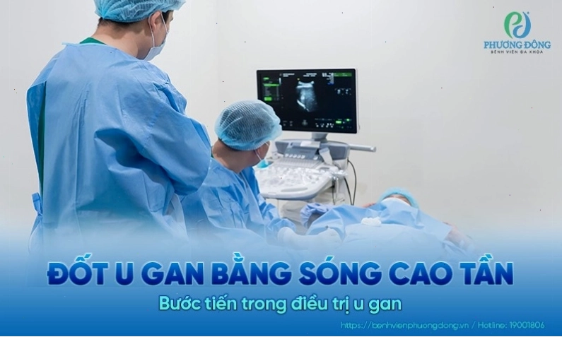 Công nghệ điều trị các bệnh lý về gan hiện đại