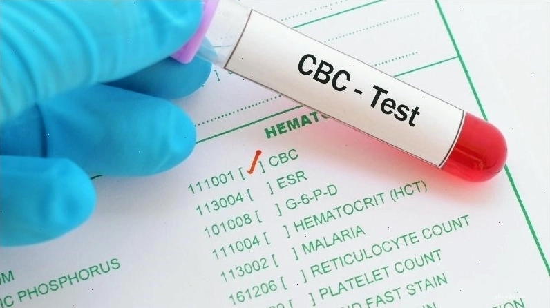 Công thức máu giúp xác định da xanh xao là do thiếu máu hay không