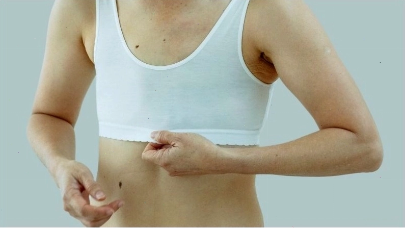 Da xanh xao là tình trạng da sáng màu bất thường