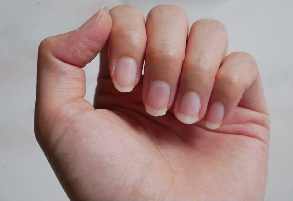 Đặc điểm bàn tay của người có một lá gan khỏe