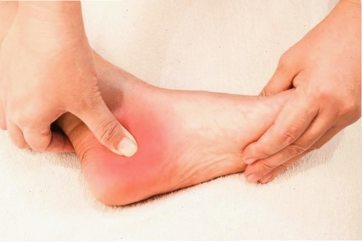 Đau gót chân xuất hiện vào mỗi sáng và cơn đau tăng lên khi thay đổi động tác