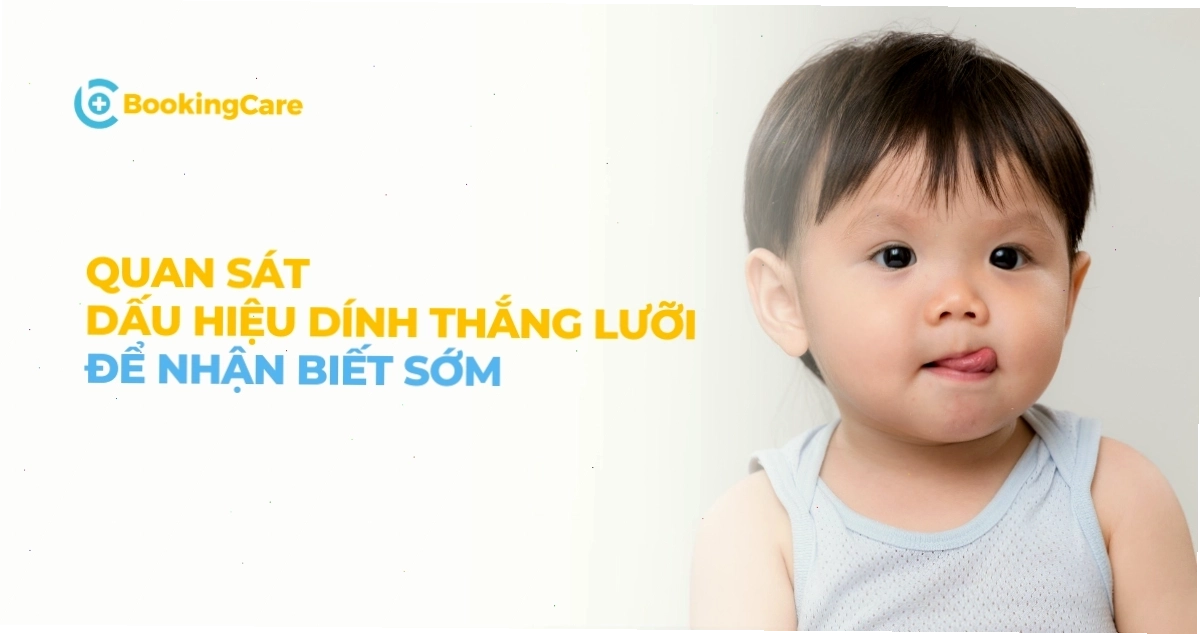 Dấu hiệu dính thắng lưỡi ở trẻ