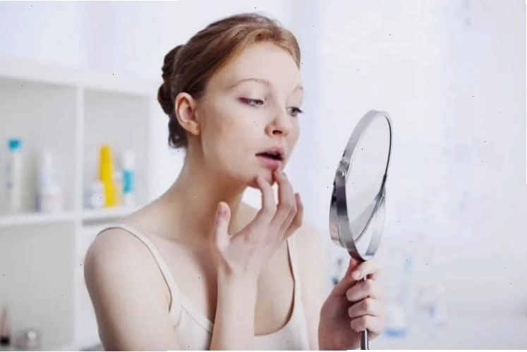 Dấu hiệu môi khô nứt nẻ do ăn quá mặn