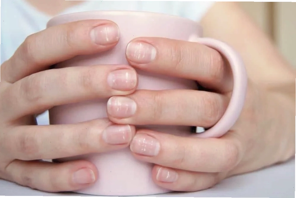 Dấu hiệu móng tay có đốm trắng cần lưu ý