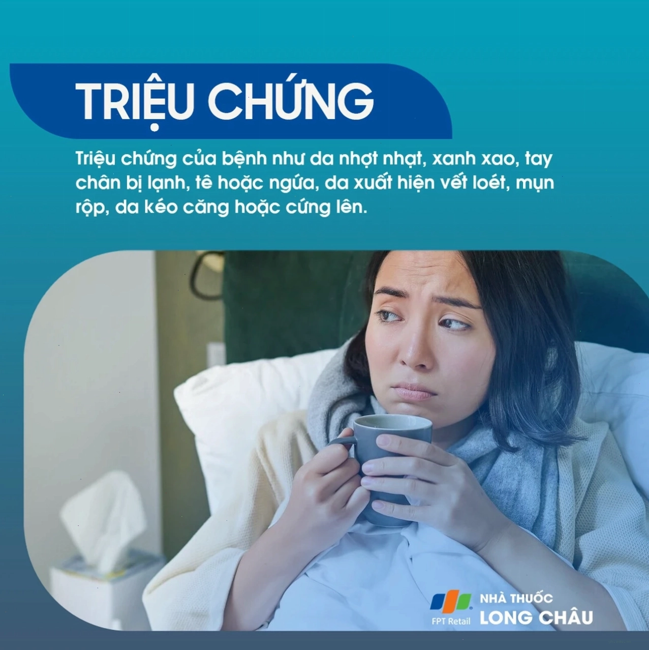 Dấu hiệu nhận biết bệnh bàn tay lạnh