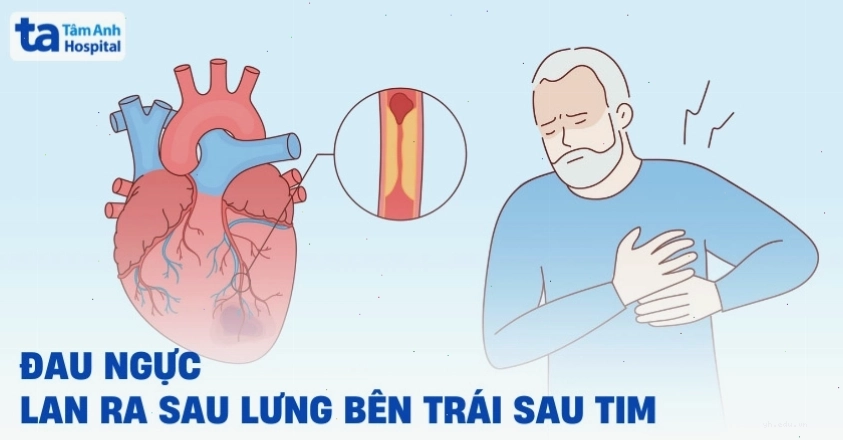 Đau nhói sau lưng