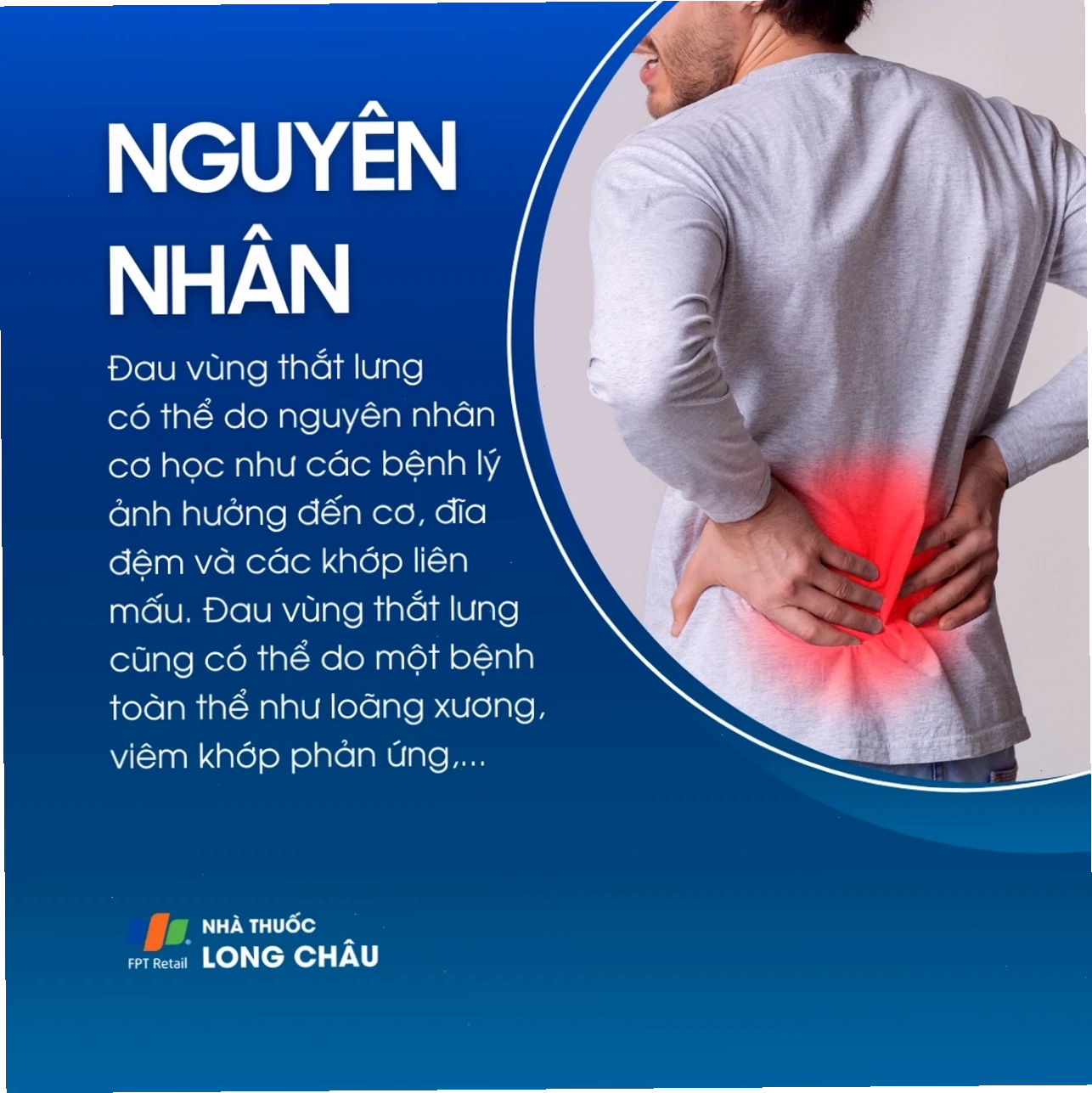 Đau vùng thắt lưng 3