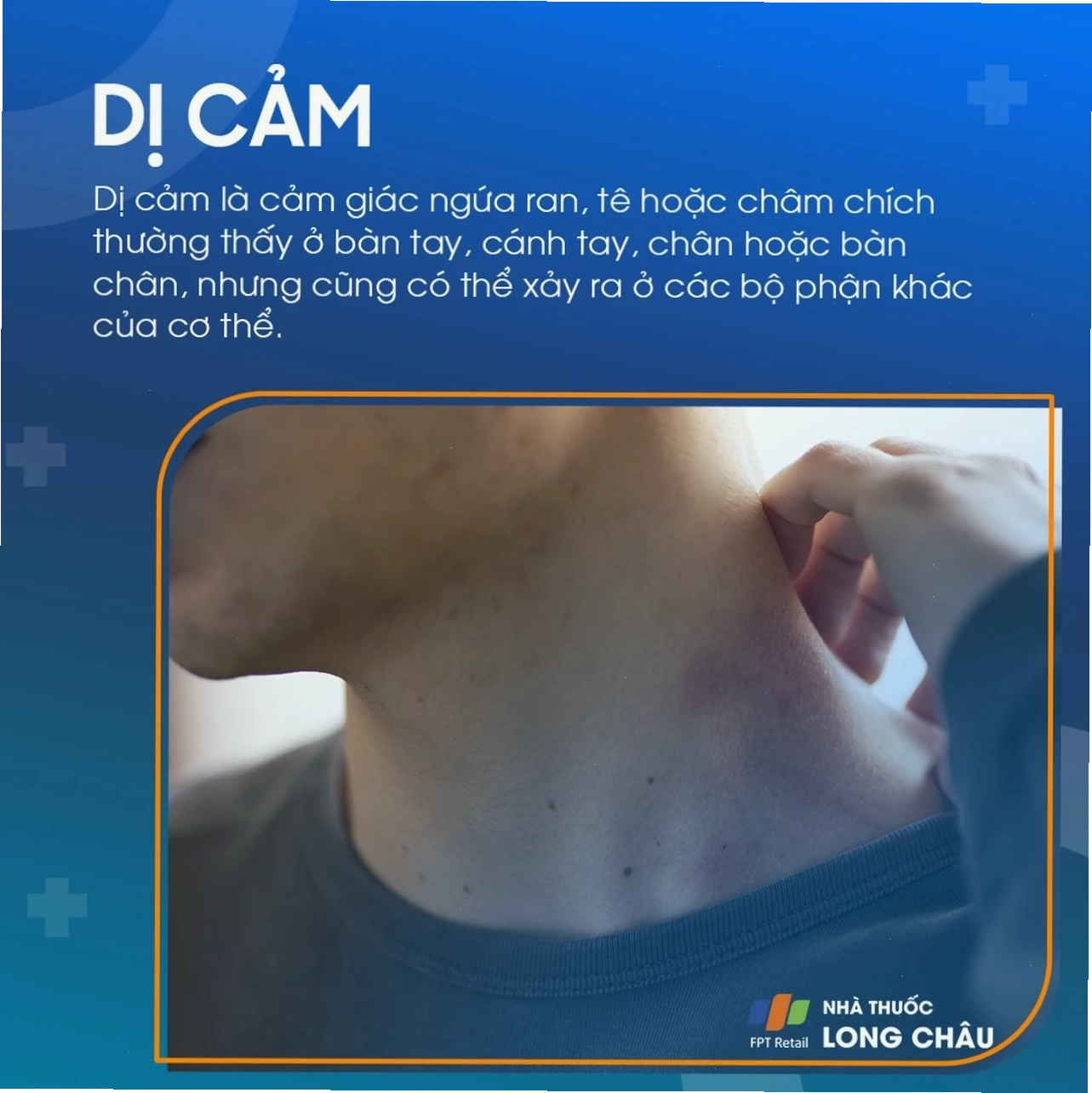 Dị Cảm 1