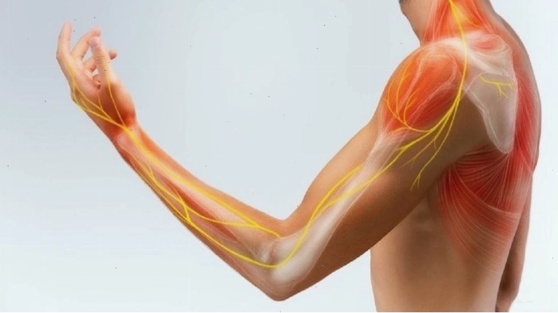 Dị cảm mạn tính có thể gặp do tổn thương thần kinh