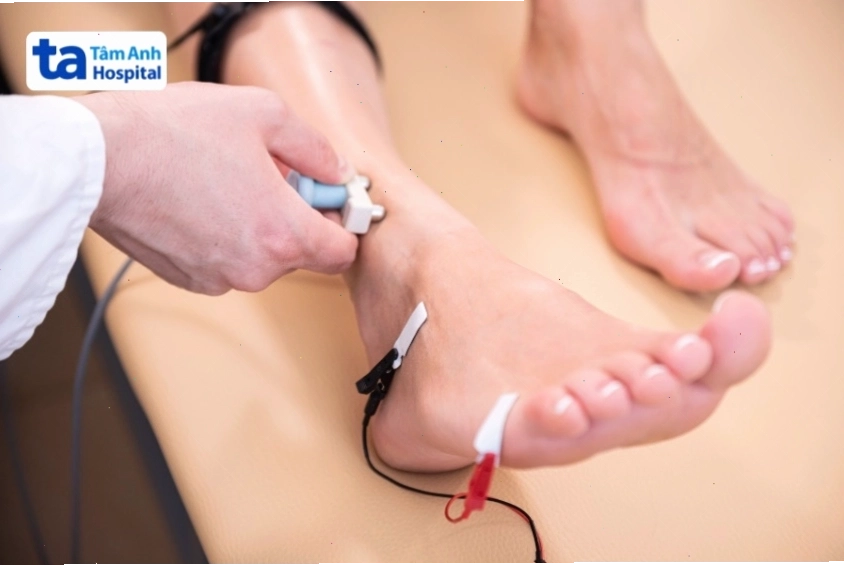 Điện cơ đồ chẩn đoán bệnh tê chân
