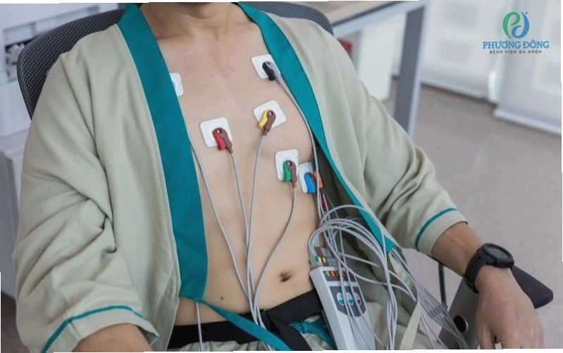Điện tâm đồ chẩn đoán