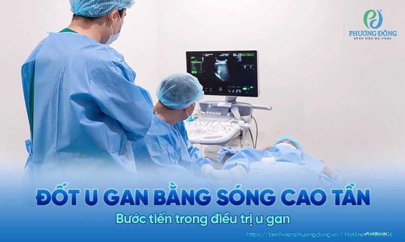 Điều trị bệnh gan bằng sóng cao tần