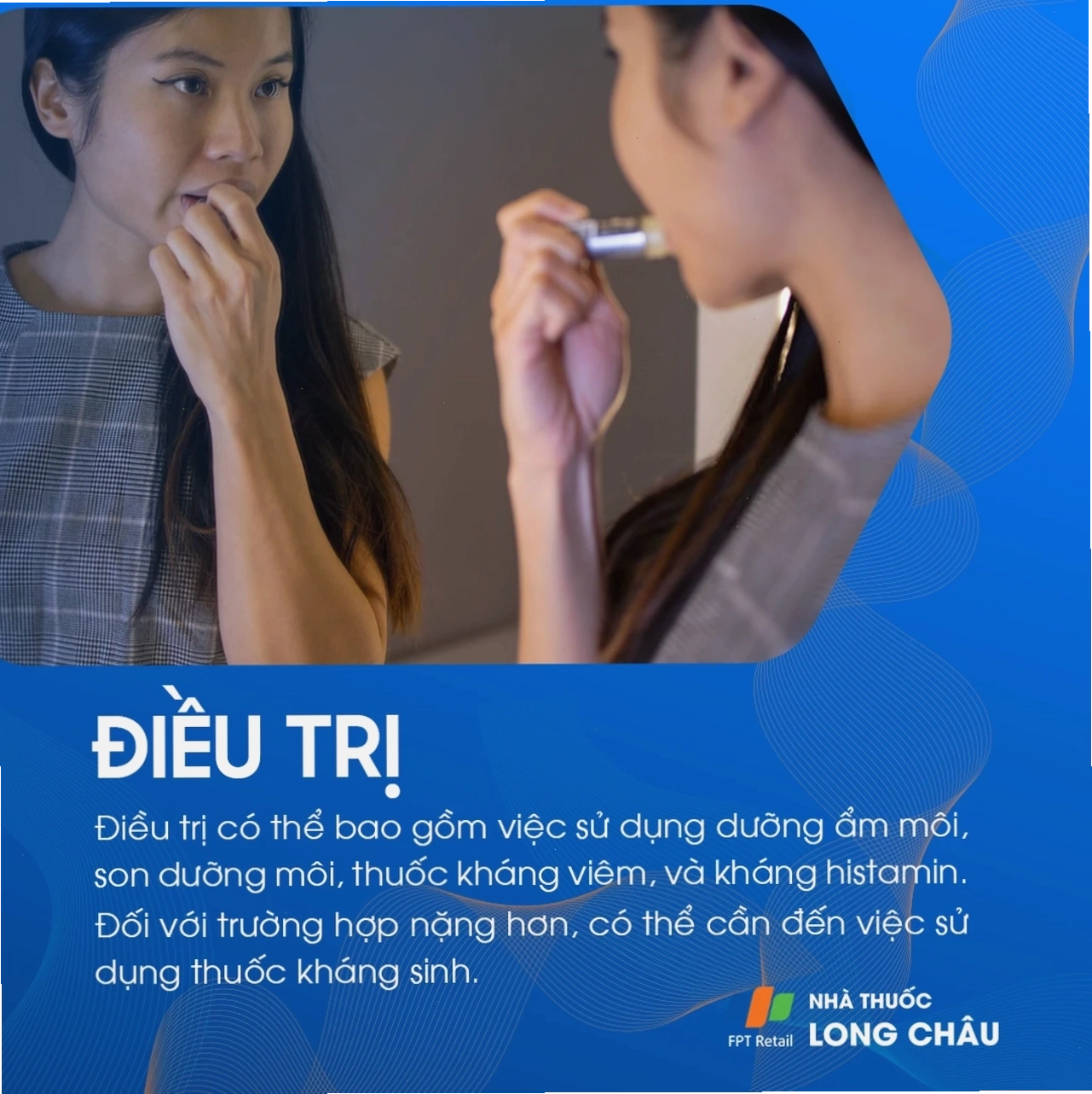 Điều trị chàm môi bằng kem dưỡng ẩm và thuốc bôi