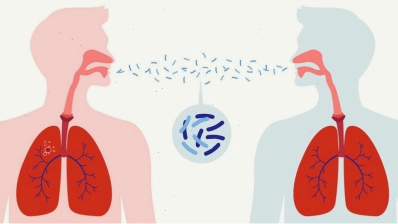 Điều trị hỗ trợ bệnh MERS