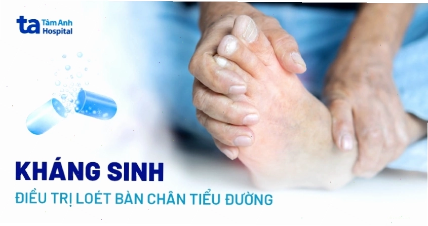 Điều trị loét bàn chân tiểu đường