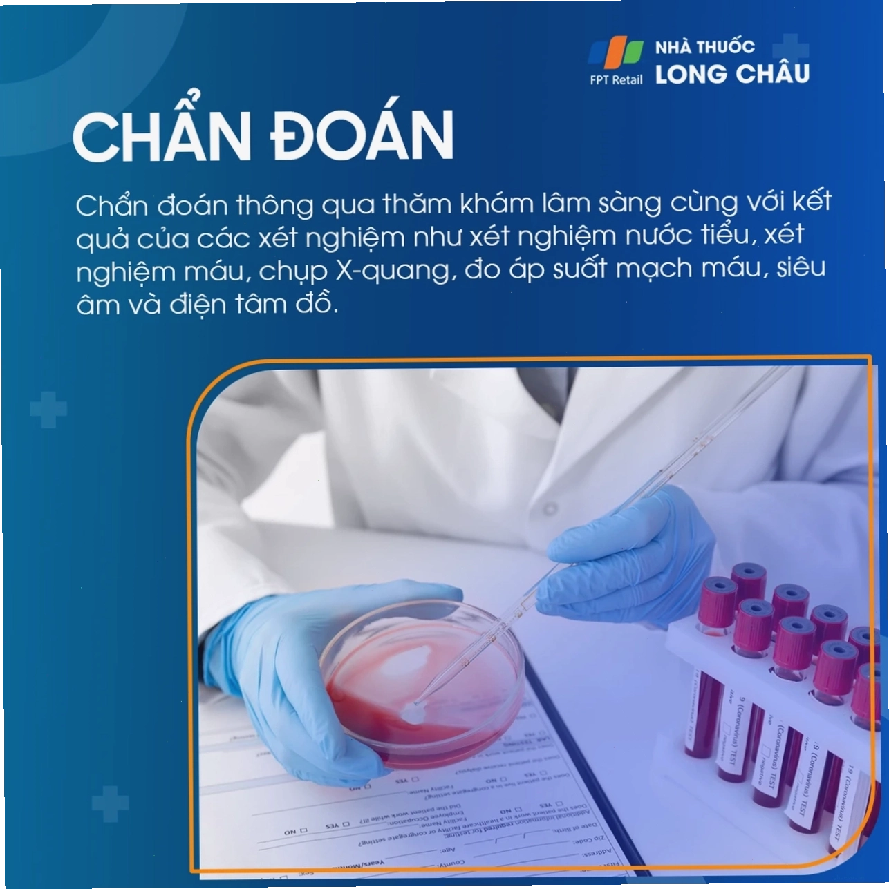 Điều trị phù chân 5