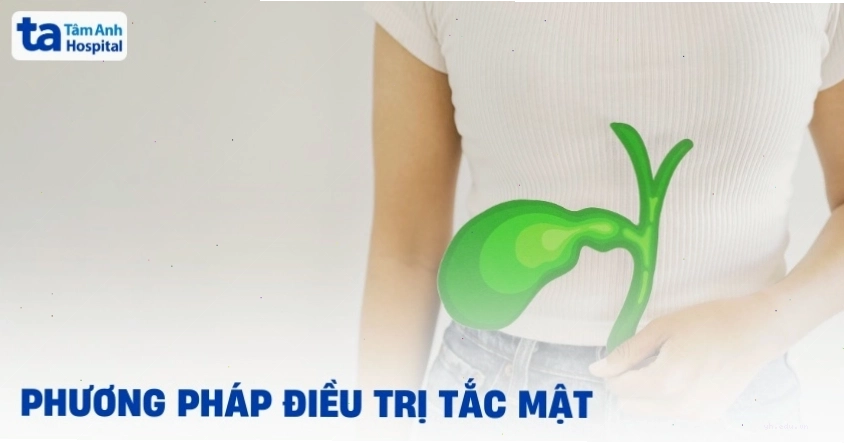 Điều trị tắc mật