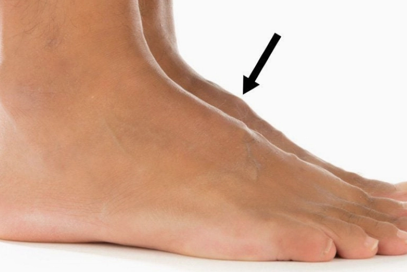 Đứng lâu bị phù chân là bệnh gì và những lưu ý y khoa quan trọng