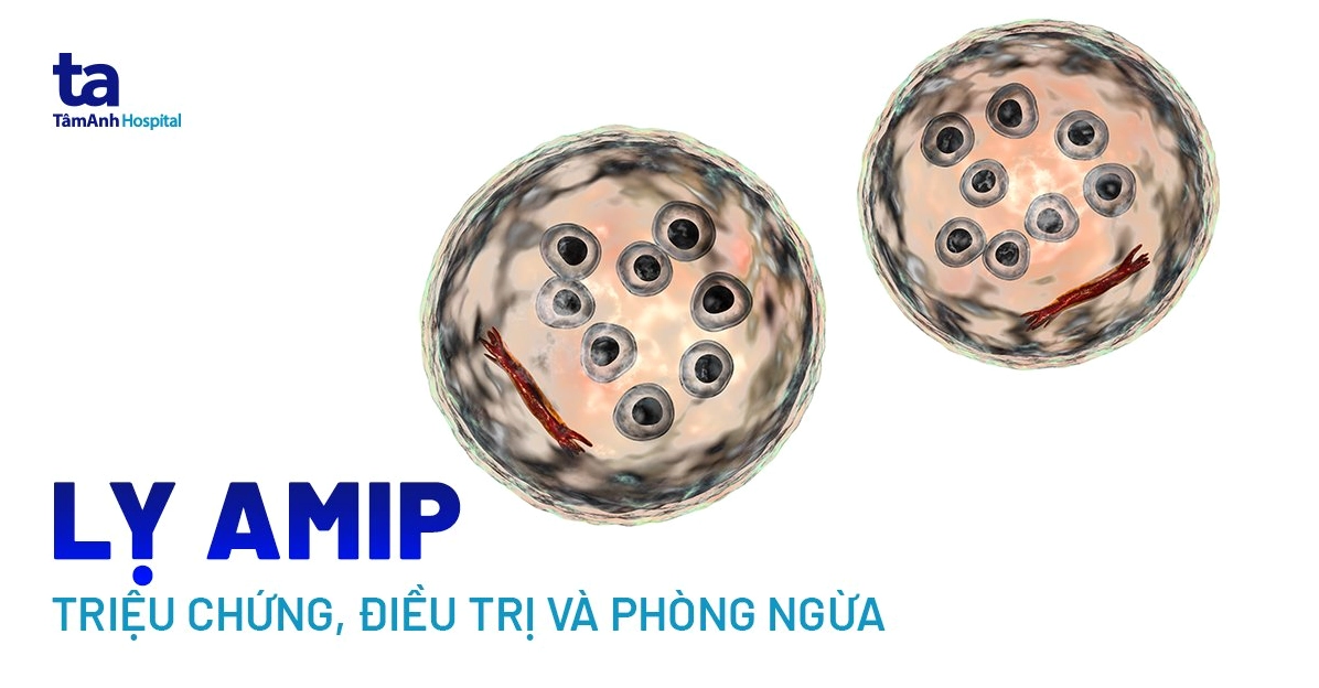 Entamoeba histolytica gây bệnh gì và những nguy cơ tiềm ẩn cho sức khỏe