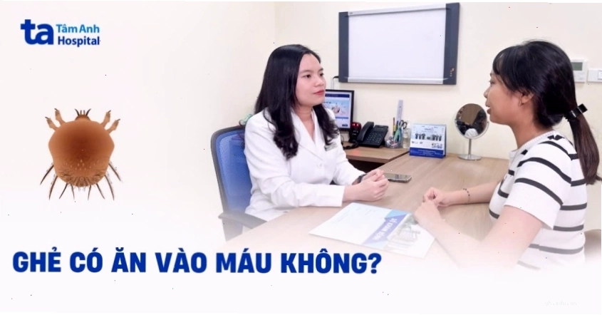 Giải đáp bệnh ghẻ có ăn vào máu không