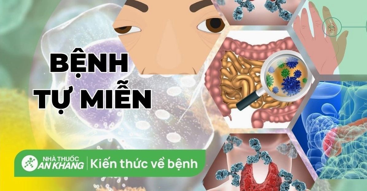 Giải đáp bí ẩn về bệnh tự nhiễm là gì và cơ chế hoạt động