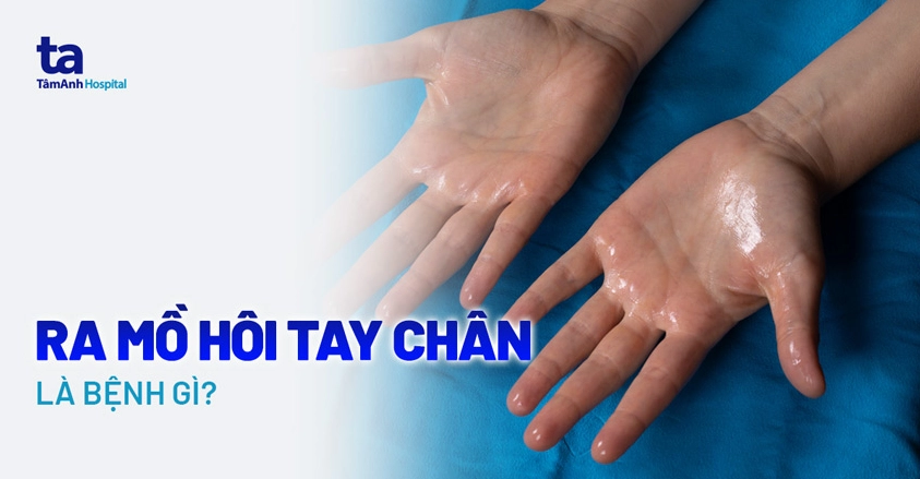 Giải đáp bị ra mồ hôi chân là bệnh gì và cách khắc phục hiệu quả