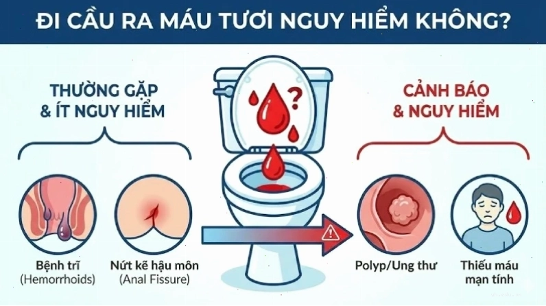 Giải đáp câu hỏi đi cầu ra máu tươi nguy hiểm không