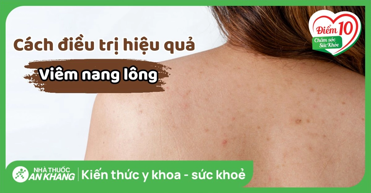 Giải đáp chi tiết về bệnh viêm nang lông là gì và cách điều trị