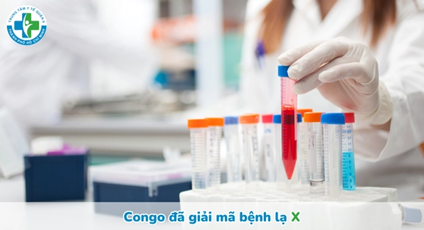 Giải đáp congo là bệnh gì và những thông tin y tế quan trọng cần biết