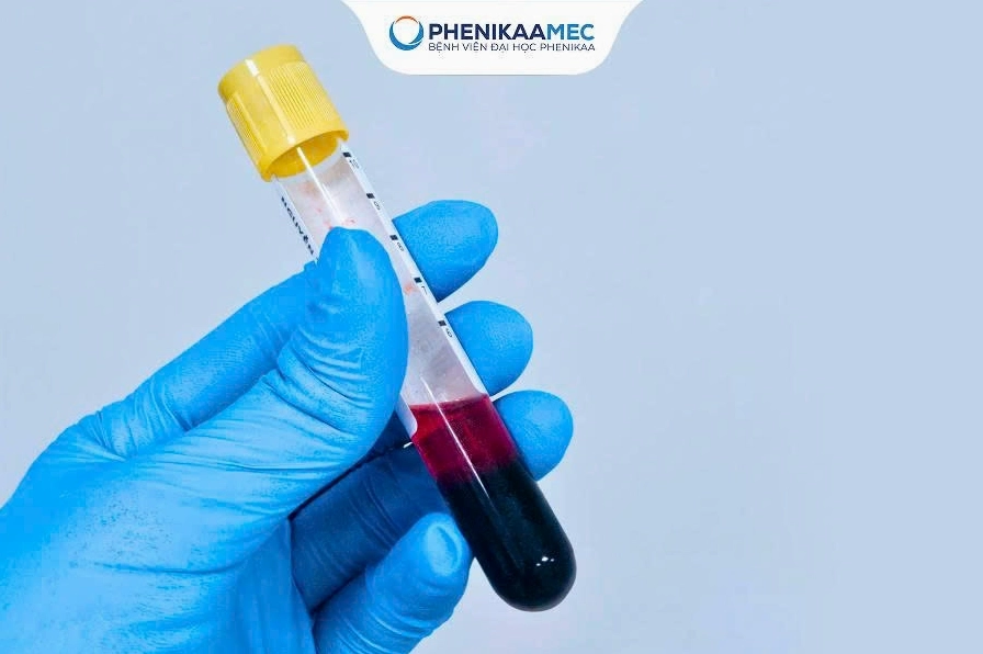 Giải đáp làm nipt phát hiện được những bệnh gì để bảo vệ bé yêu