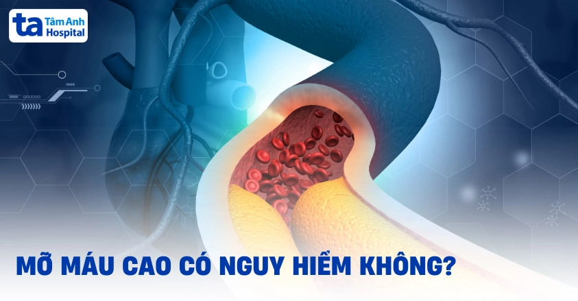 Giải đáp mỡ máu cao dẫn đến bệnh gì và cách phòng ngừa hiệu quả