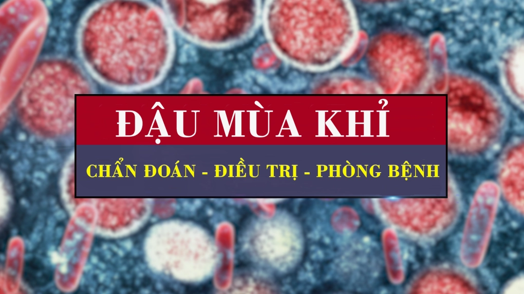 Giải đáp thắc mắc bệnh ban khỉ la bệnh gì và thông tin y khoa cần biết