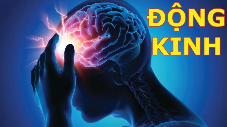 Giải đáp thắc mắc bệnh đông kinh là gì và những điều cần biết