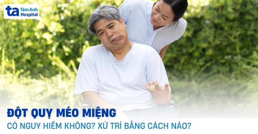 Giải đáp thắc mắc bị méo mồm là bệnh gì và cách xử trí y khoa kịp thời
