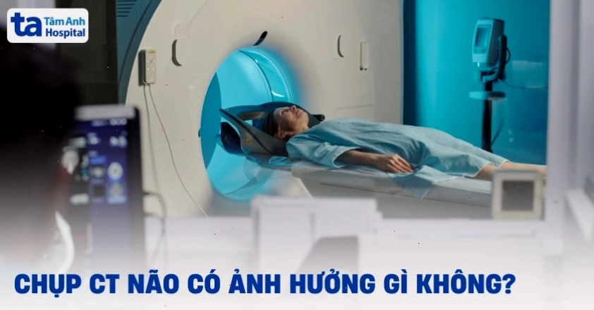 Giải đáp thắc mắc chụp CT não có ảnh hưởng không
