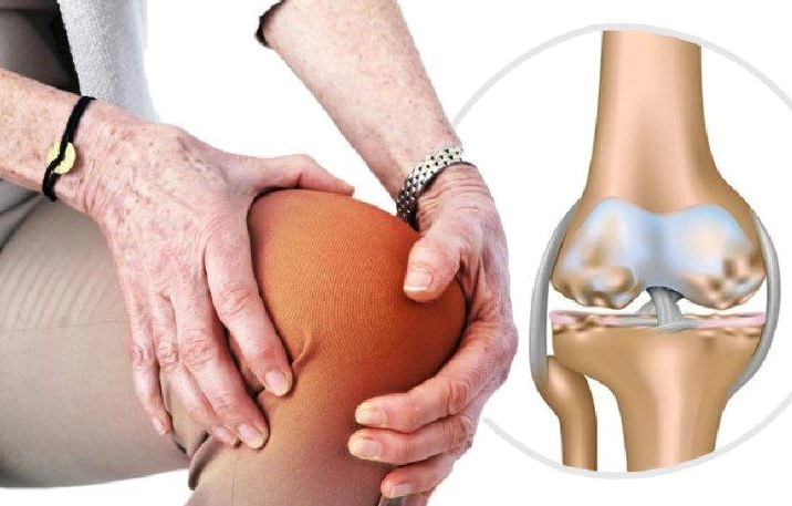 Giải đáp thắc mắc đầu gối kêu rắc rắc là bệnh gì và cách xử lý