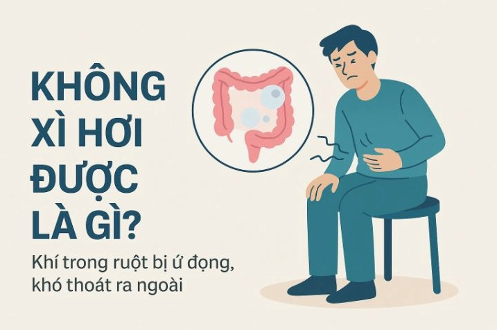 Giải đáp thắc mắc không xì hơi được là bệnh gì và cách xử lý