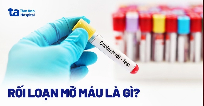 Giải đáp thắc mắc rối loạn mỡ máu là bệnh gì và cách phòng ngừa