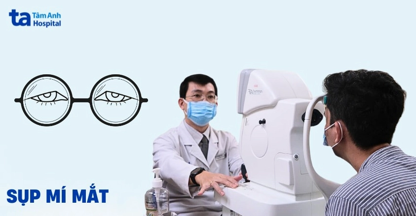 Giải đáp thắc mắc sụp mi là bệnh gì cùng các dấu hiệu cần lưu ý
