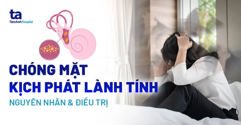 Giải đáp thắc mắc vertigo là bệnh gì và những lưu ý y khoa quan trọng