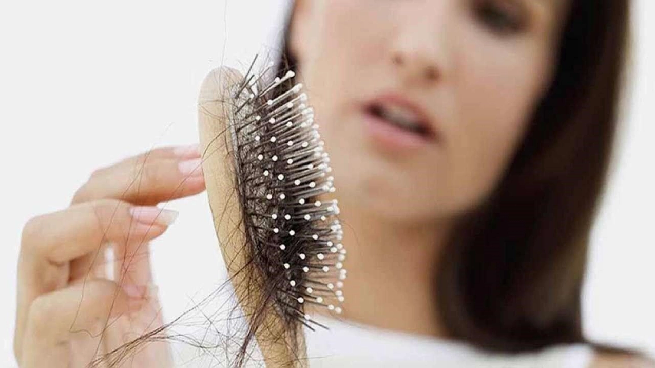 Giải đáp tự nhiên tóc rụng nhiều là bệnh gì và cách xử lý hiệu quả