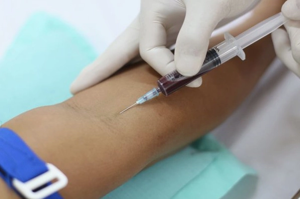 Giải đáp y khoa máu đen là bị bệnh gì và khi nào cần đi khám