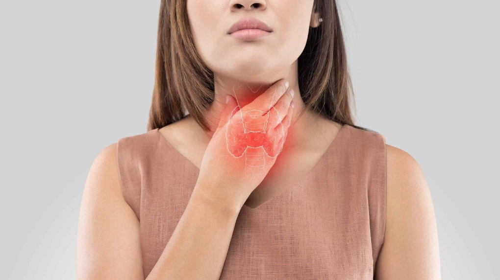 Giải mã bệnh cường giáp ở phụ nữ là gì và cách bảo vệ tuyến giáp