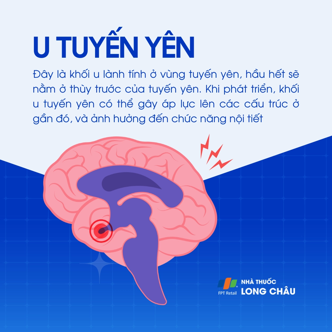 Giải mã bệnh tuyến yên là gì và những kiến thức y khoa quan trọng