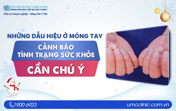 Giải mã hiện tượng đầu ngón tay bị đen là bệnh gì và cách nhận diện