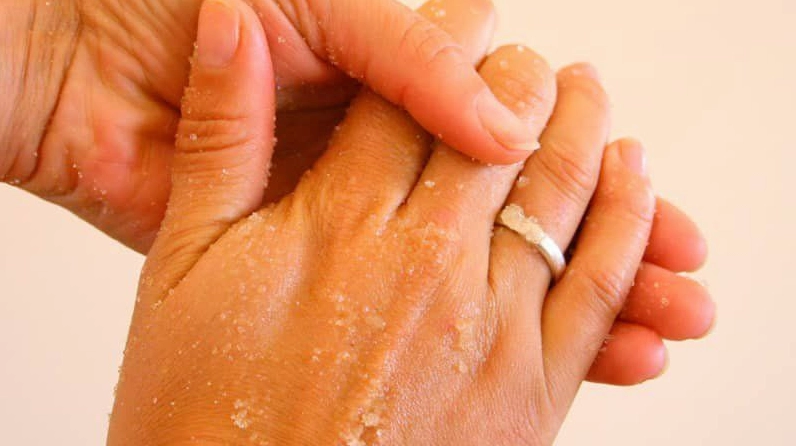 Giải mã lòng bàn tay khô là bệnh gì cùng các dấu hiệu cần cảnh giác