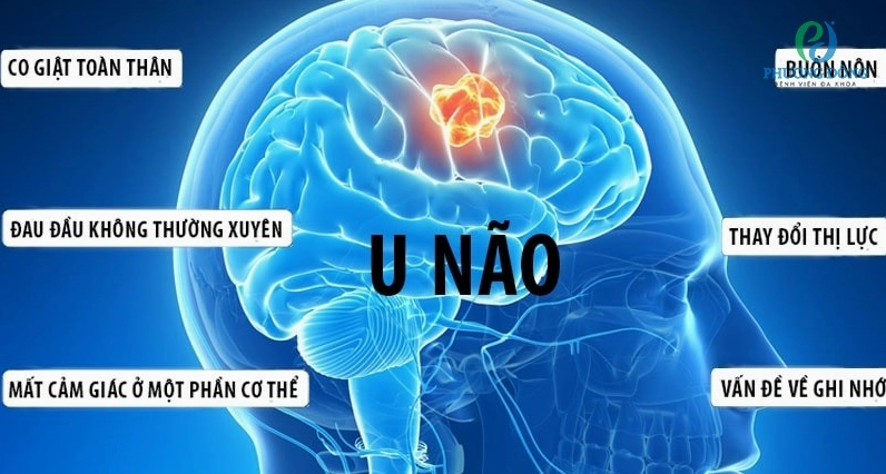 Giải mã thông tin về việc lê quý bình bị bệnh gì theo góc độ y khoa