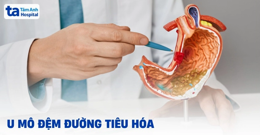 Gist là bệnh gì và những thông tin y khoa quan trọng cần biết